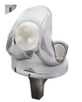 total knee replacement implant total knee replacement implant